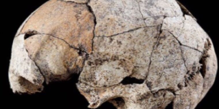এই 5,300 বছরের পুরানো খুলিটি প্রাচীনতম পরিচিত কানের অস্ত্রোপচারের প্রমাণ দেখায়